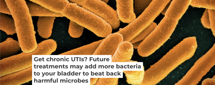 Certain strains of E. coli can outcompete disease-causing microbes for resources. NIAID/Flickr, CC BY-SA